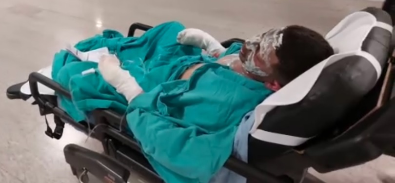 Yaktığı ateşe tiner döken genç ağır yaralandı